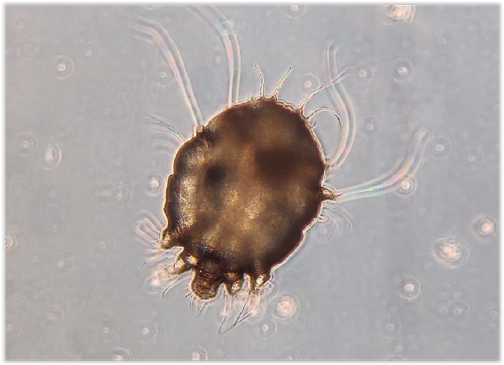 Syyhy scabies 