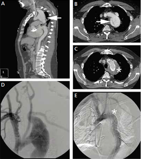 Marfanin Oireyhtym n Ehlers Danlosin Oireyhtym n Ja Marfanin Oireyhtym n Ehlers Danlosin Oireyhtym n Ja